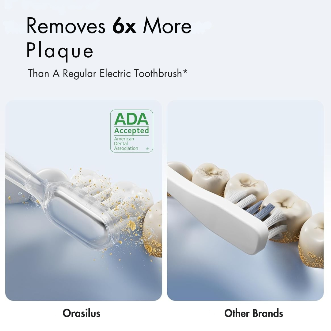 Orasilus Premium Electric Toothbrush – Deep Cleaning & Whitening